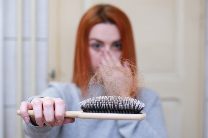 Лысеет каждый второй: косметолог рассказал, почему лезут волосы после ковида и как их восстановить