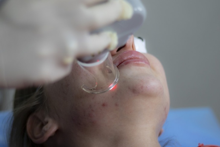 Может и до менингита дойти: дерматолог рассказала об опасных воспалениях на лице в холода