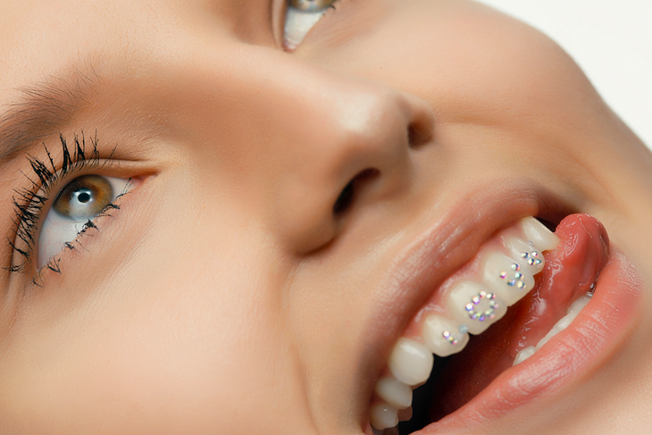 Стоматолог объяснил, почему нельзя украшать зубы стразами