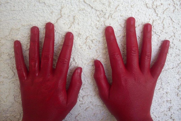 Пальцы — «барабанные палочки», ногти — «часовые стрелки»: как по рукам можно определить болезни