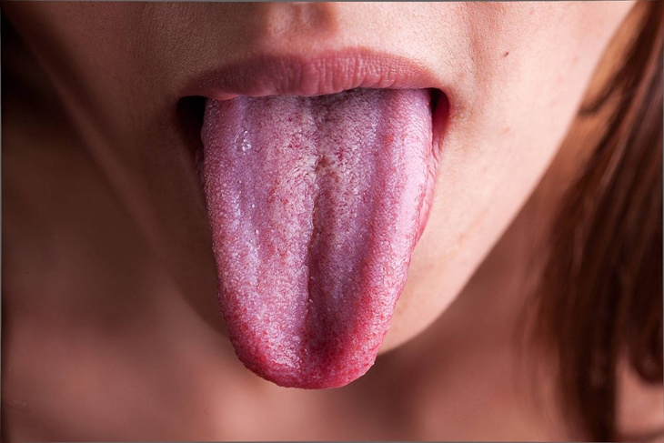 Постоянно пахнет изо рта и болит горло: названы главные симптомы редчайшей формы рака