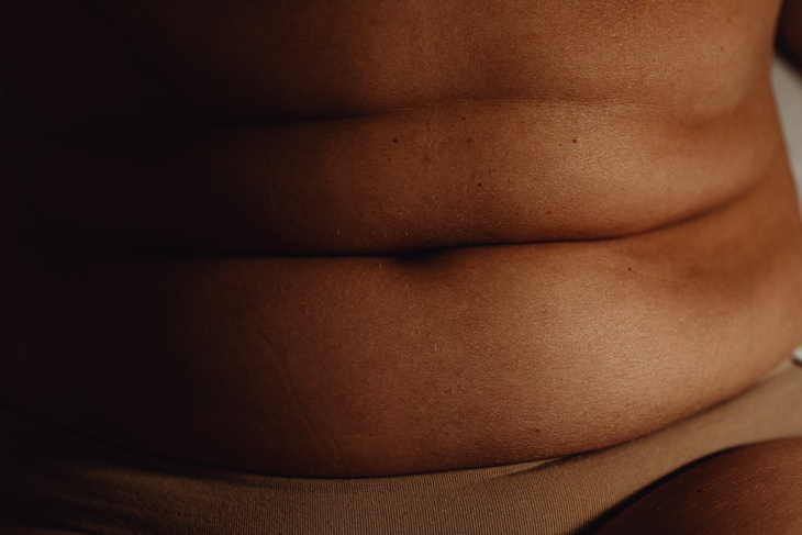 Профессор Ковальков рассказал, что ожирение передается по наследству